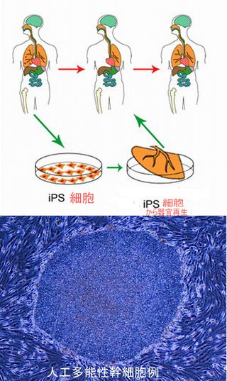 IPS_cells